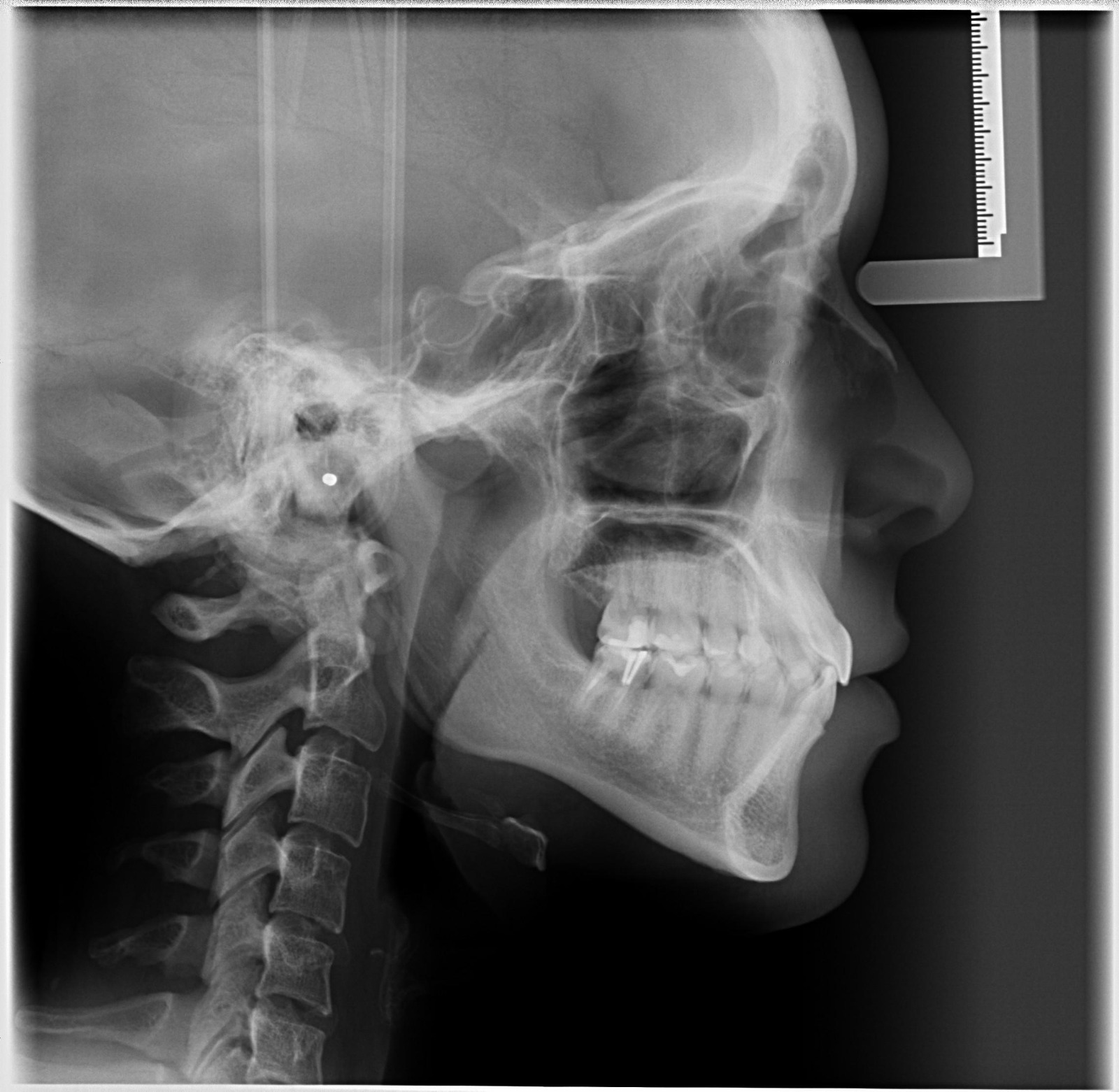 telerradiografia