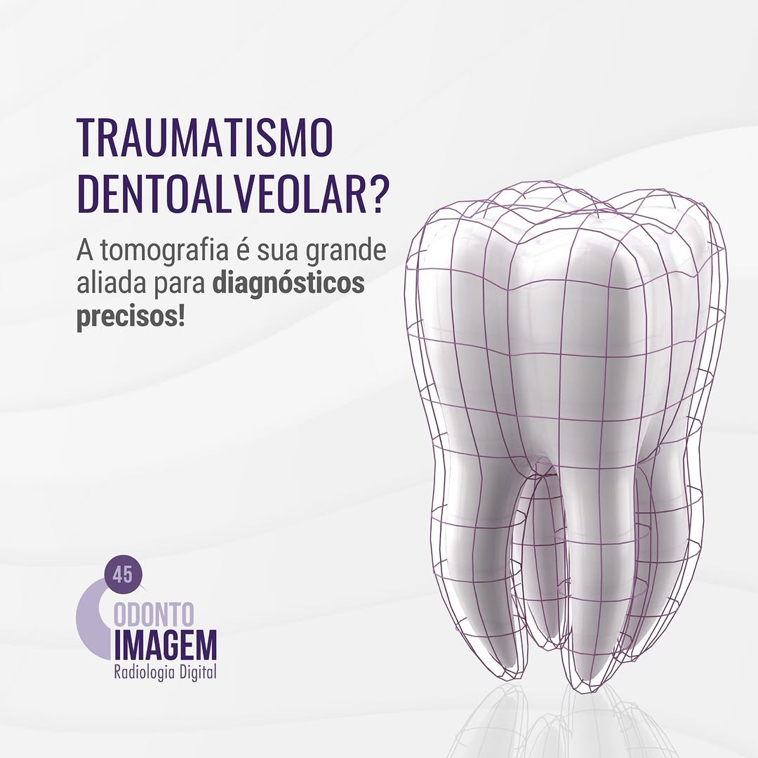 traumatismo-dentoalveolar
