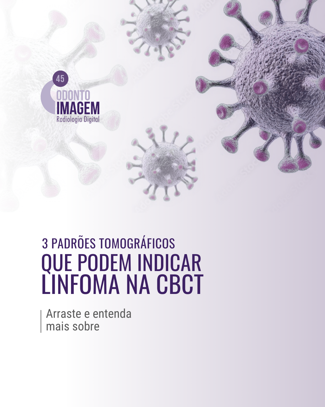 3-padroes-tomograficos-que-podem-indicar-linfoma-na-cbct