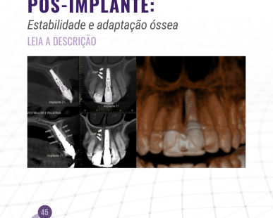 avaliacao-pos-implante