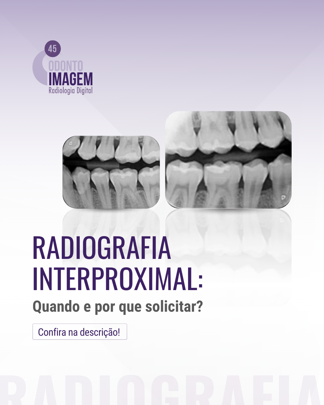 radiografia-interproximal